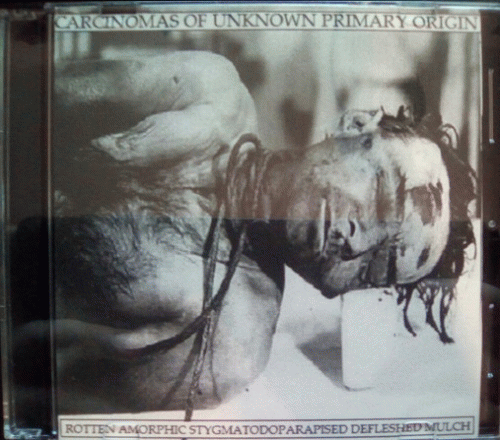 Carcinomas Of Unknown Primary Origin : Rotten Amorphic Stygmatodoparapised Defleshed Mulch